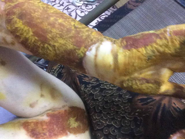 Chỉ đạo xử lý kỷ luật vụ học sinh bị bỏng ở trường THPT Phan Đình Phùng 